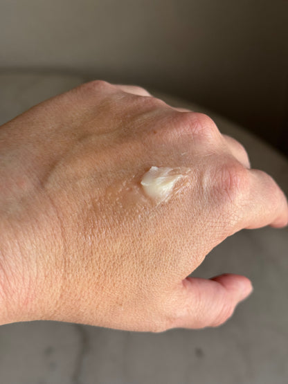 Balm on hand